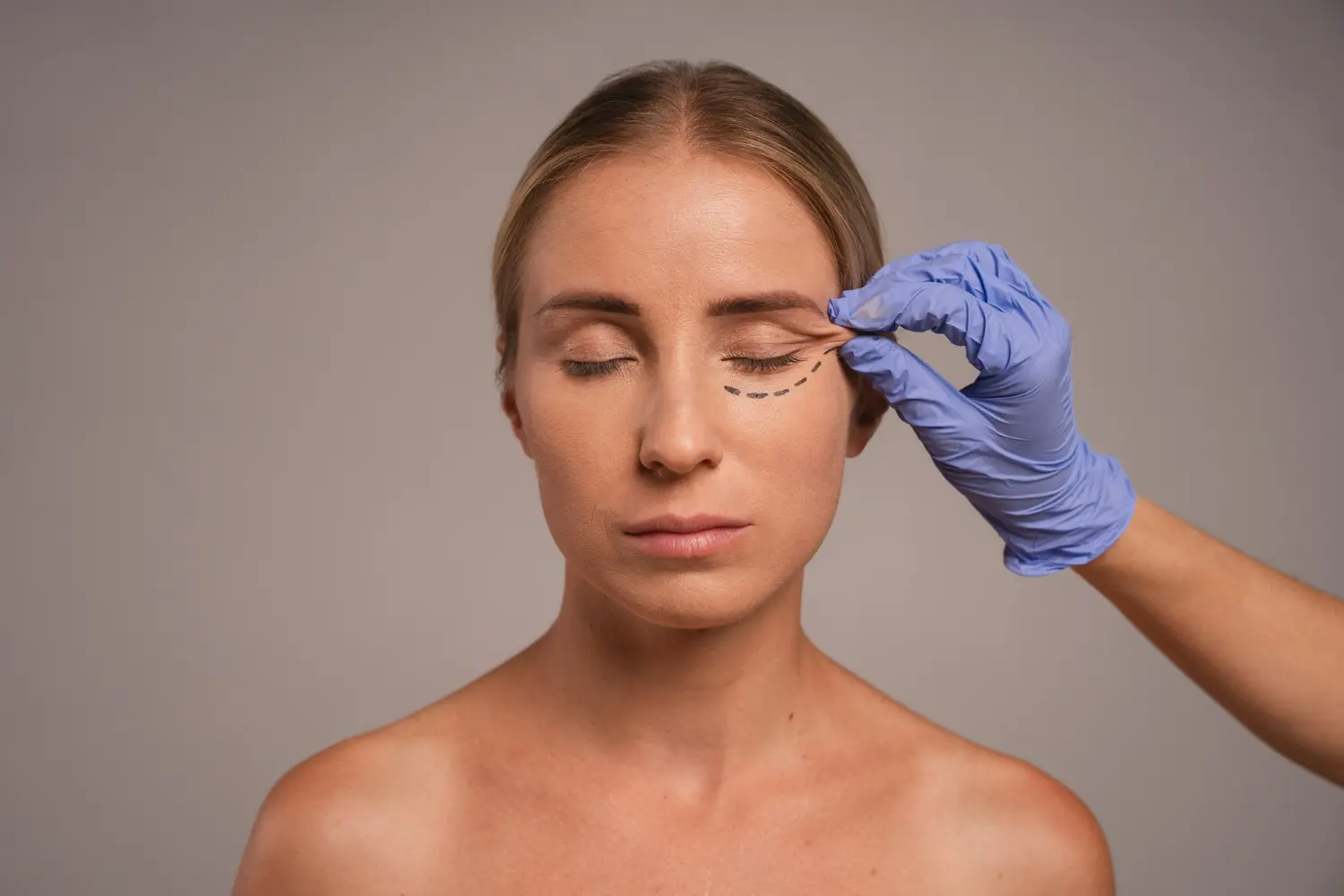 Blefaroplastia
